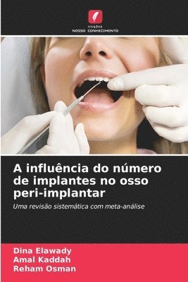 bokomslag A influncia do nmero de implantes no osso peri-implantar