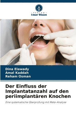 bokomslag Der Einfluss der Implantatanzahl auf den periimplantren Knochen