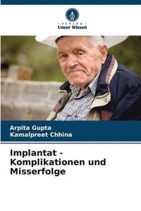 bokomslag Implantat - Komplikationen und Misserfolge