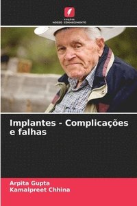 bokomslag Implantes - Complicações e falhas