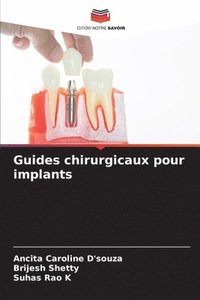 bokomslag Guides chirurgicaux pour implants