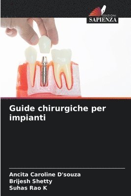 bokomslag Guide chirurgiche per impianti