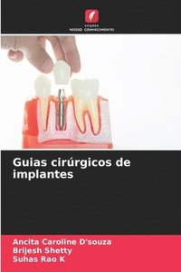 bokomslag Guias cirrgicos de implantes