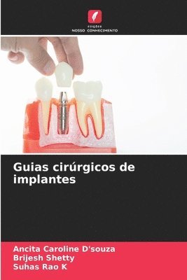 bokomslag Guias cirrgicos de implantes