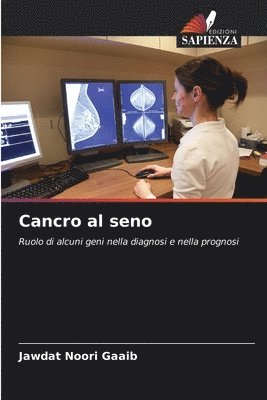 bokomslag Cancro al seno