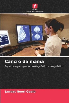 bokomslag Cancro da mama