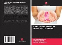 bokomslag Carcinoma Lobular Invasivo Da Mama