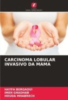 bokomslag Carcinoma Lobular Invasivo Da Mama