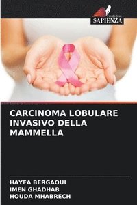 bokomslag Carcinoma Lobulare Invasivo Della Mammella