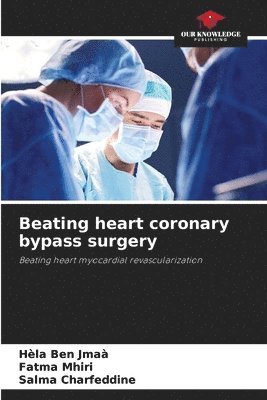 bokomslag Beating heart coronary bypass surgery