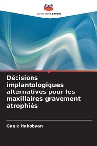 bokomslag Dcisions implantologiques alternatives pour les maxillaires gravement atrophis