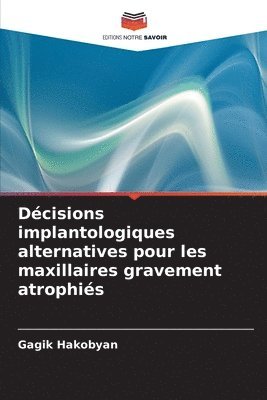 bokomslag Décisions implantologiques alternatives pour les maxillaires gravement atrophiés