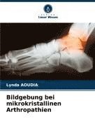 bokomslag Bildgebung bei mikrokristallinen Arthropathien