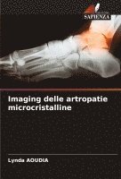 bokomslag Imaging delle artropatie microcristalline