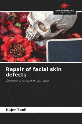 bokomslag Repair of facial skin defects