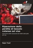 bokomslag Riparazione della perdita di tessuto cutaneo sul viso