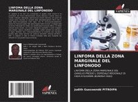 bokomslag Linfoma Della Zona Marginale del Linfonodo