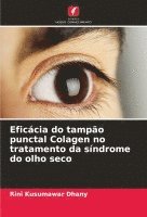 Eficácia do tampão punctal Colagen no tratamento da síndrome do olho seco