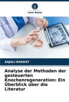 bokomslag Analyse der Methoden der gesteuerten Knochenregeneration