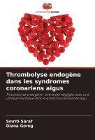 bokomslag Thrombolyse endogne dans les syndromes coronariens aigus