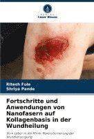 Fortschritte und Anwendungen von Nanofasern auf Kollagenbasis in der Wundheilung