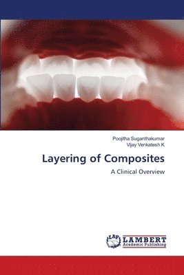 bokomslag Layering of Composites