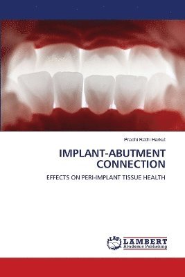 bokomslag Implant-Abutment Connection