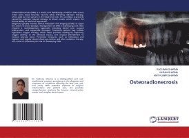 Rachana Sharma, Vikram Sharma, Amit Kumar Sharma, RACHANA SHARMA - Osteoradionecrosis, Häftad
