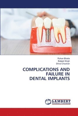 bokomslag Complications and Failure in Dental Implants