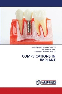 bokomslag Complications in Implant