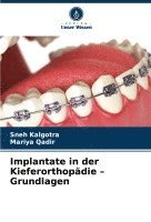 Sneh Kalgotra, Mariya Qadir - Implantate in der Kieferorthopädie - Grundlagen, Häftad
