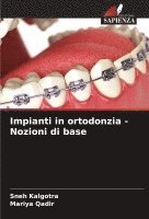 Impianti in ortodonzia - Nozioni di base 1