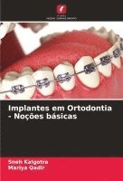 bokomslag Implantes em Ortodontia - Noes bsicas