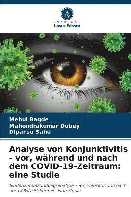 Mehul Bagde, Mahendrakumar Dubey, Dipansu Sahu - Analyse von Konjunktivitis - vor, während und nach dem COVID-19-Zeitraum, Häftad