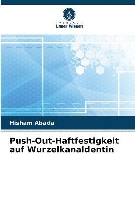 Push-Out-Haftfestigkeit auf Wurzelkanaldentin 1