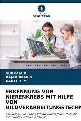 bokomslag Erkennung Von Nierenkrebs Mit Hilfe Von Bildverarbeitungstechniken