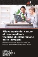 bokomslag Rilevamento del cancro al rene mediante tecniche di elaborazione delle immagini