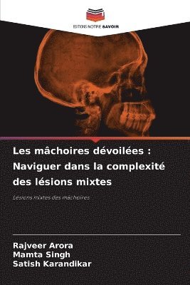 Les mâchoires dévoilées