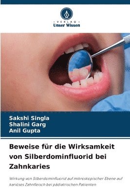 Beweise fr die Wirksamkeit von Silberdominfluorid bei Zahnkaries 1