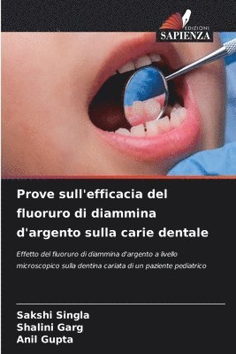 Prove sull'efficacia del fluoruro di diammina d'argento sulla carie dentale