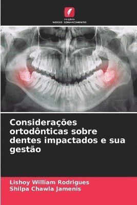 bokomslag Consideraes ortodnticas sobre dentes impactados e sua gesto