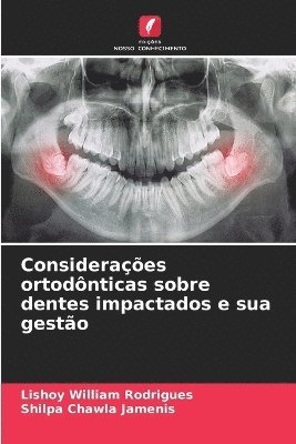 Lishoy William Rodrigues, Shilpa Chawla Jamenis - Considerações ortodônticas sobre dentes impactados e sua gestão, Häftad