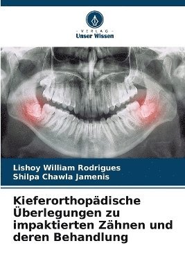 Kieferorthopdische berlegungen zu impaktierten Zhnen und deren Behandlung 1