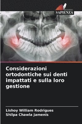 Considerazioni ortodontiche sui denti impattati e sulla loro gestione 1