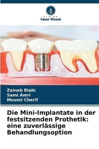 bokomslag Die Mini-Implantate in der festsitzenden Prothetik