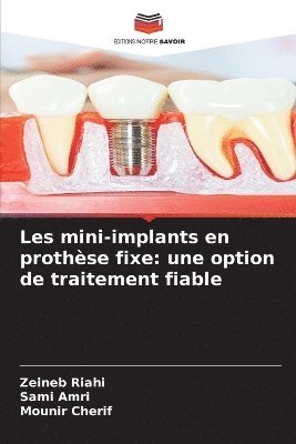 Zeineb Riahi, Sami Amri, Mounir Cherif - Les mini-implants en prothèse fixe, Häftad