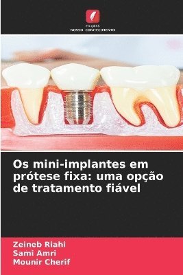 Zeineb Riahi, Sami Amri, Mounir Cherif - Os mini-implantes em prótese fixa, Häftad