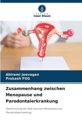 bokomslag Zusammenhang zwischen Menopause und Parodontalerkrankung