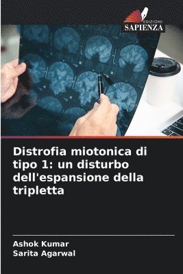 bokomslag Distrofia miotonica di tipo 1