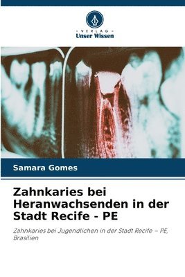 Zahnkaries bei Heranwachsenden in der Stadt Recife - PE 1